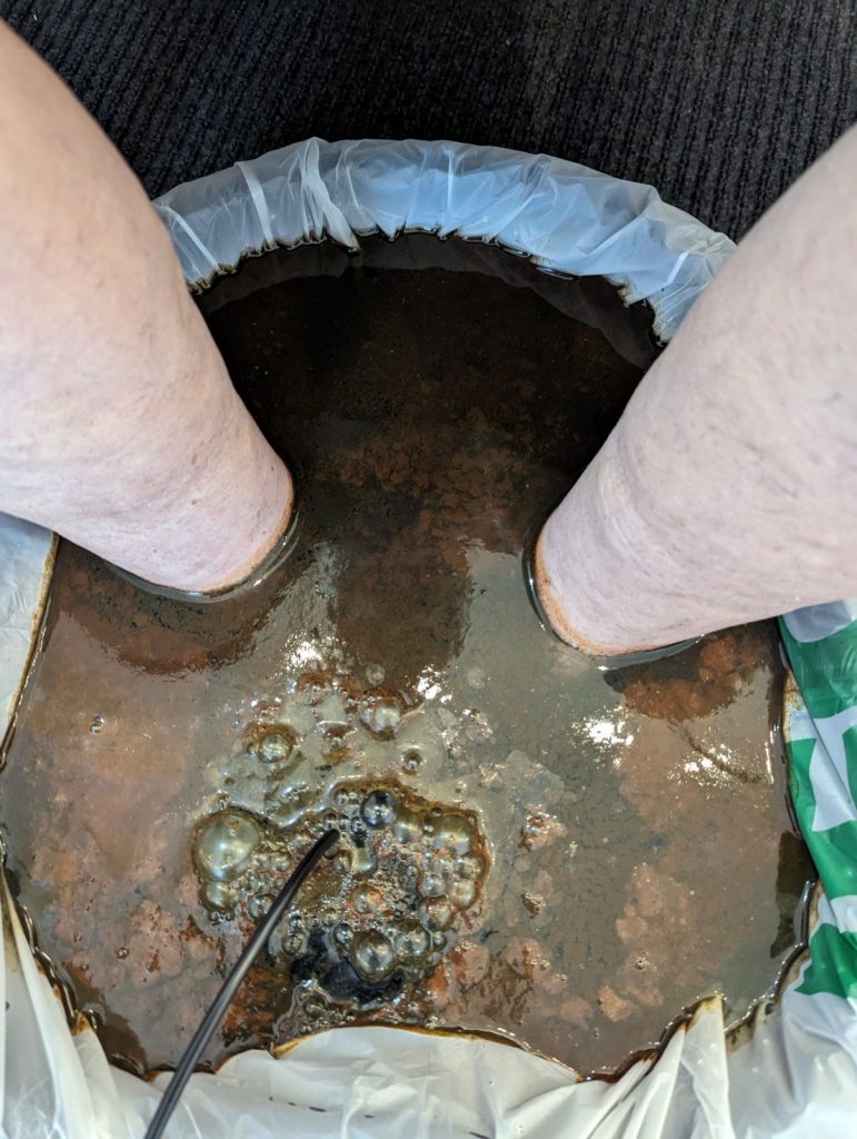 Feet in ionic foot detox bath
