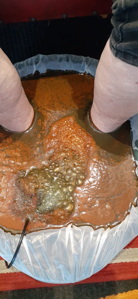 Ionic foot detox water showing toxins drawn from the body